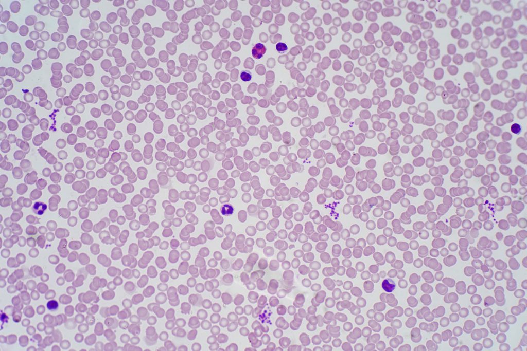 Neutropenia